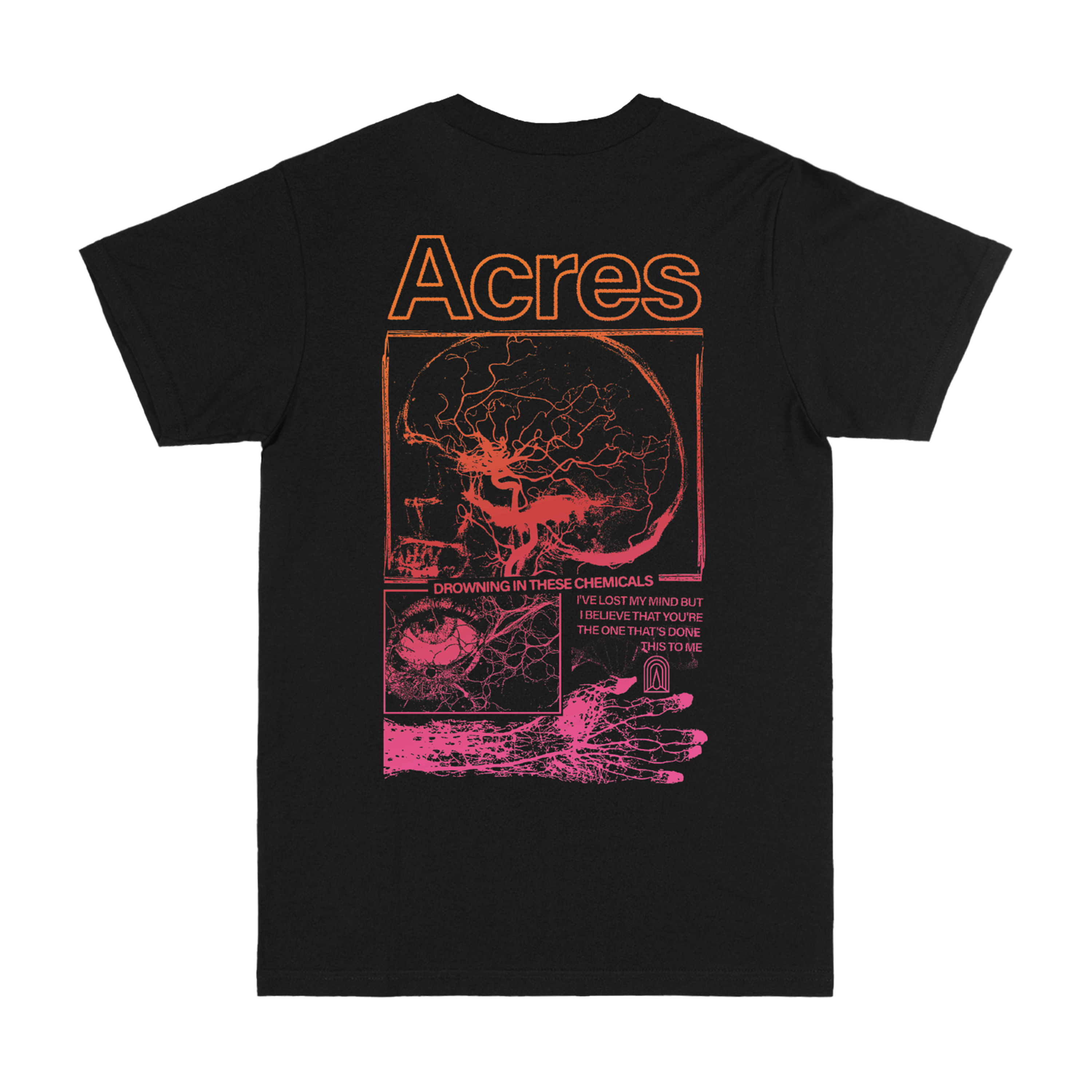 ACRES - Acres Black Tee